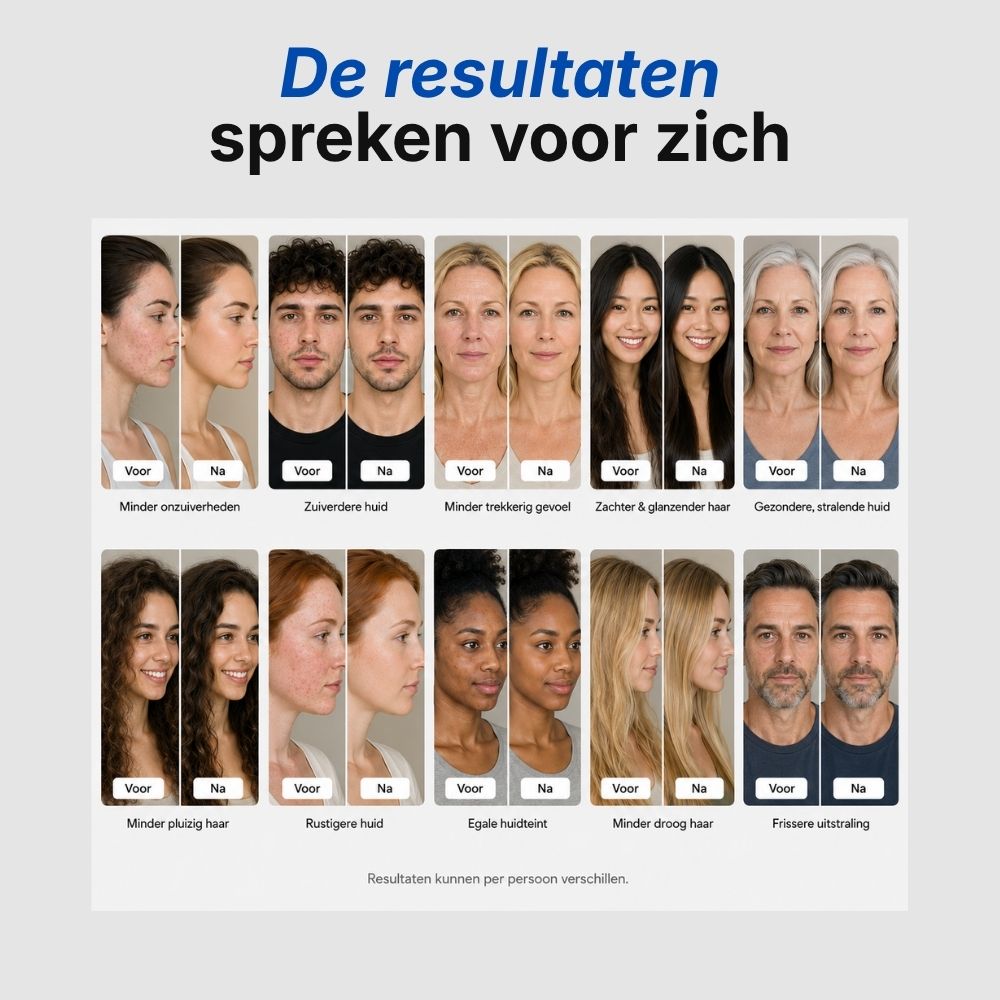 Klense Filter Douchekop